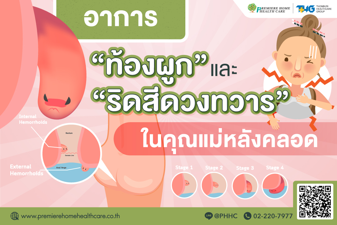 ริดสีดวงคุณแม่หลังคลอด