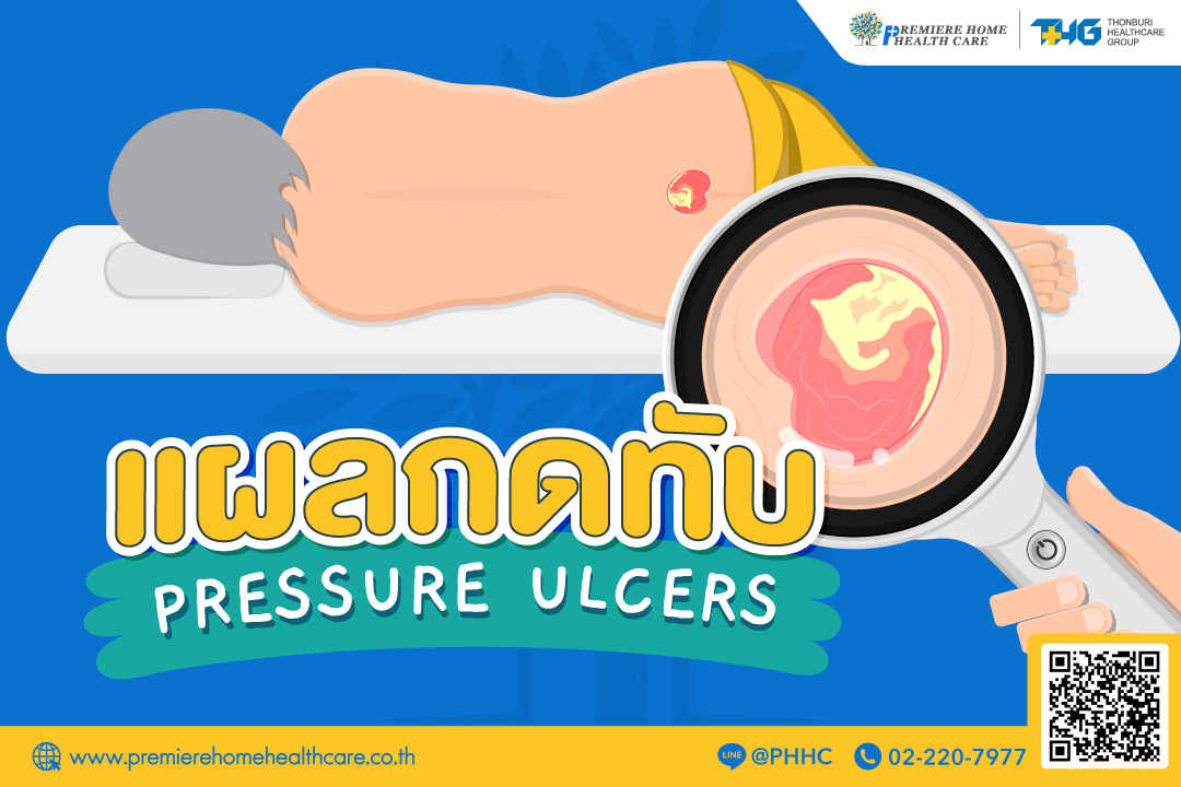 แผลกดทับ