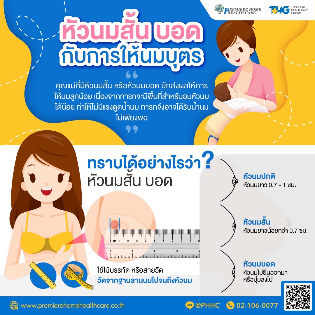 หัวนมสั้น/บอด กับการให้นมบุตร
