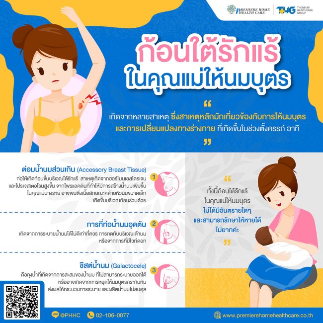 ก้อนใต้รักแร้ในคุณแม่